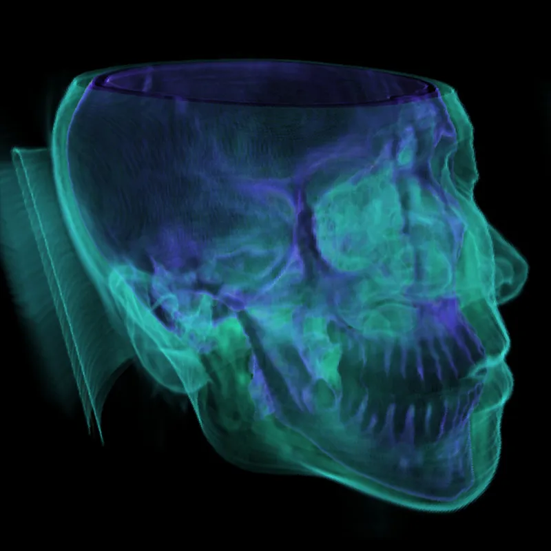 Visualization of volumetric data